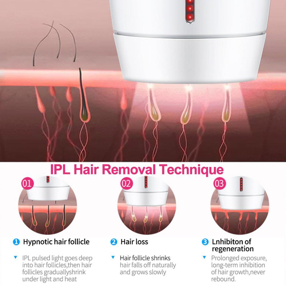 Home Laser Hair Removal Instrument - RareGloo